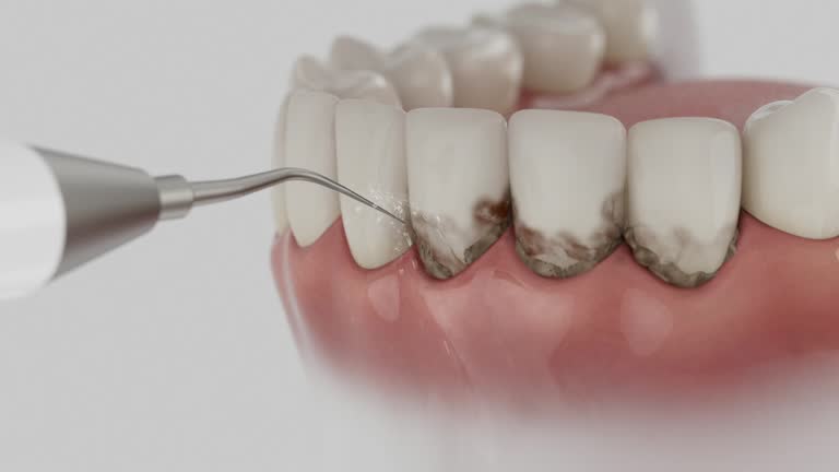 Reliable Dental contractor in Lewisville, WA by Dentist Open Now